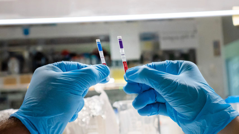Coronavirus: confirmaron 57 muertos y 10.614 nuevos contagios en Argentina