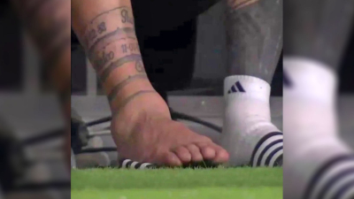 Tras salir en la final, así quedó el tobillo de Messi