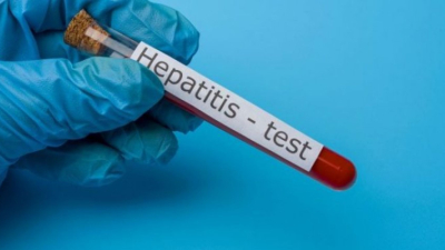 Hepatitis: hay unos 6.000 contagiados por día
