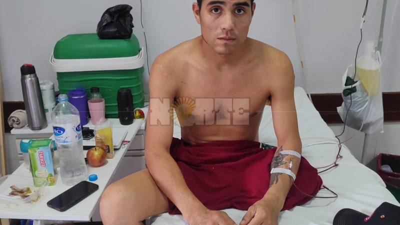 "Logré ponerme un dedo en el agujero donde entró la bala"