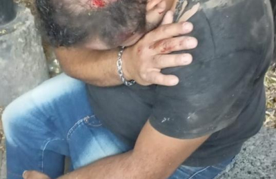 Un mecánico fue brutalmente golpeado cuando lo asaltaron