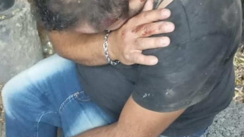 Un mecánico fue brutalmente golpeado cuando lo asaltaron