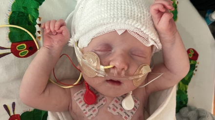 A-baby-becomes-first-in-the-world03.jpg