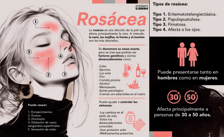 rosàcea copia.jpg