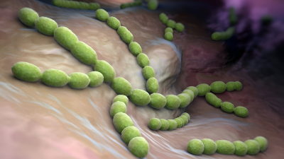 Neumonía, meningitis y otras enfermedades causadas por neumococos