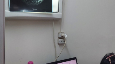 Camión sanitario para mamografías gratuitas