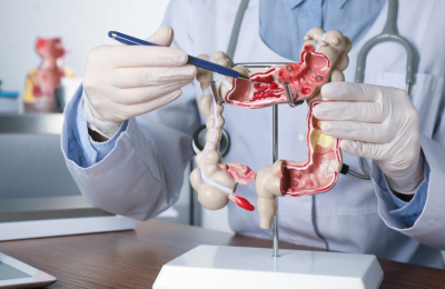 Un tumor frecuente que se puede prevenir y que afecta a pacientes cada vez más jóvenes