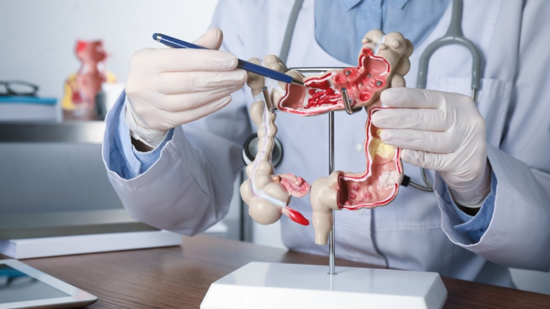 Un tumor frecuente que se puede prevenir y que afecta a pacientes cada vez más jóvenes