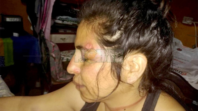 Violencia de género en Charata: “Me salvó mi hijo, sino me mataba”