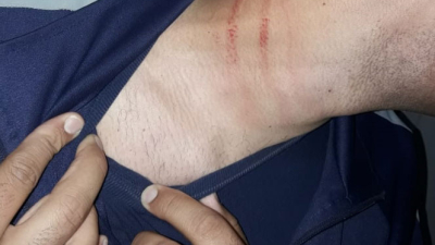 Delincuente huyó de la comisaría Séptima, fue perseguido y lesionó a tres efectivos