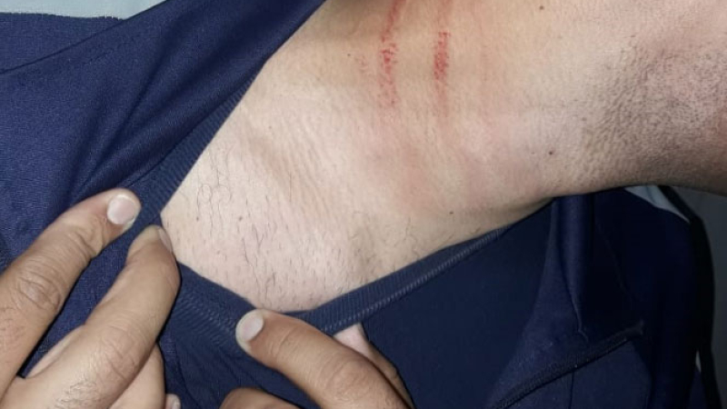 Delincuente huyó de la comisaría Séptima, fue perseguido y lesionó a tres efectivos