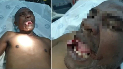 Una doctora le arrancó la lengua a un hombre cuando intentaba violarla dentro de un hospital en Sudáfrica