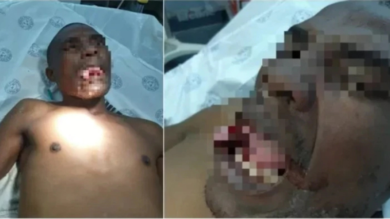 Una doctora le arrancó la lengua a un hombre cuando intentaba violarla dentro de un hospital en Sudáfrica