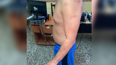 Convivencia en cuarentena: una pelea de pareja terminó con un hombre herido y semidesnudo en la comisaría