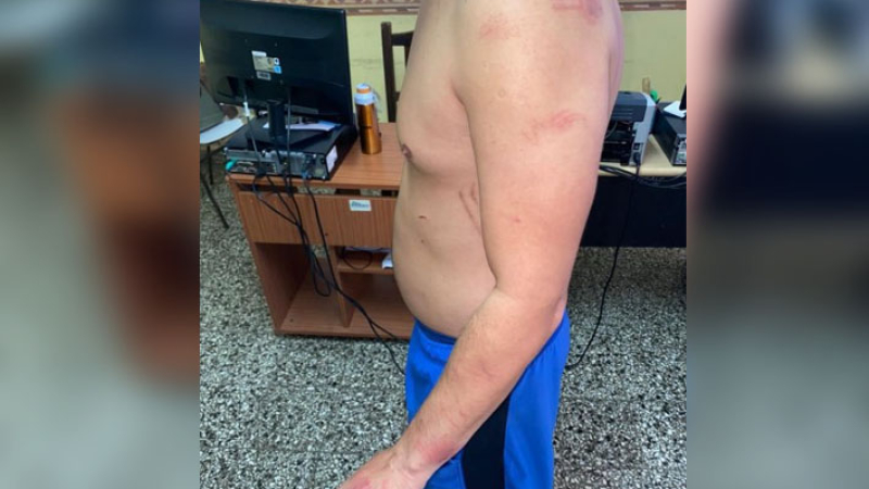 Convivencia en cuarentena: una pelea de pareja terminó con un hombre herido y semidesnudo en la comisaría
