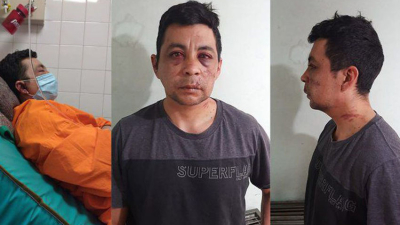 Murió un enfermero que había sido atacado por sus vecinos al contagiarse de coronavirus: “Sufrió mucho”