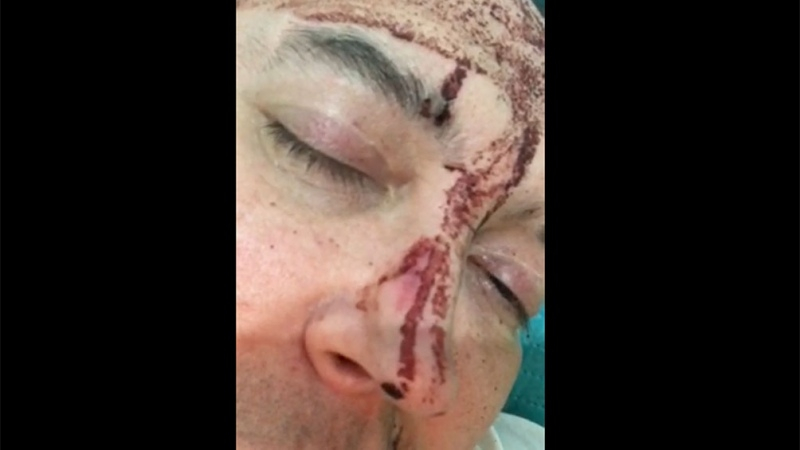 Leo García sufrió un ataque homofóbico