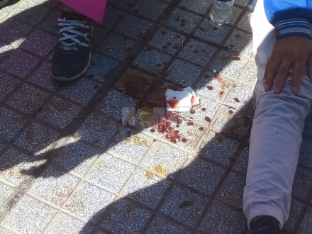 hombre autolesionado 2.jfif