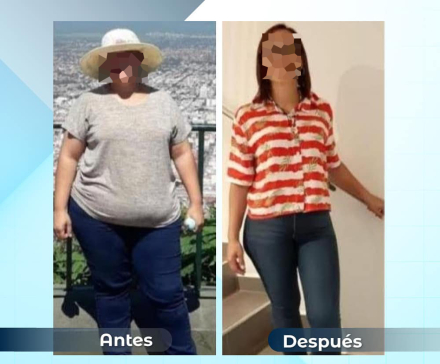 1antesydespues13.jpg