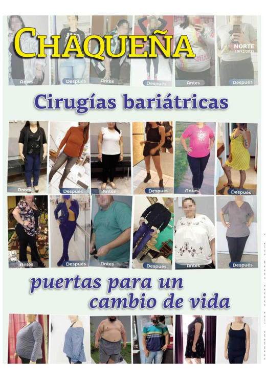Cirugías bariátricas: puertas para un cambio de vida