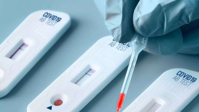 Los primeros autotest de Covid estarían disponibles la próxima semana en farmacias, a 1.560 pesos