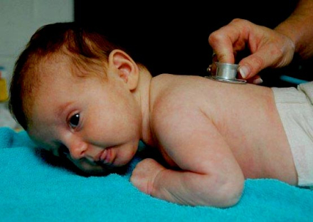 bronquiolitis2.jpg