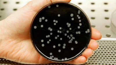 Legionella: hace casi una década la UNNE viene estudiándola y alerta sobre la importancia de estudios epidemiológicos