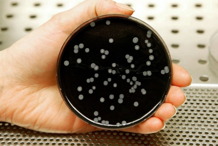 Legionella.jpg