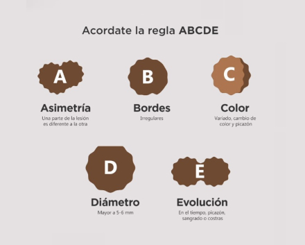 abcde.jpg