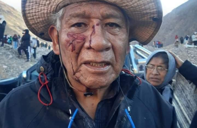 Jujuy: la mitad de los habitantes es pobre y 78.000 personas pasan hambre