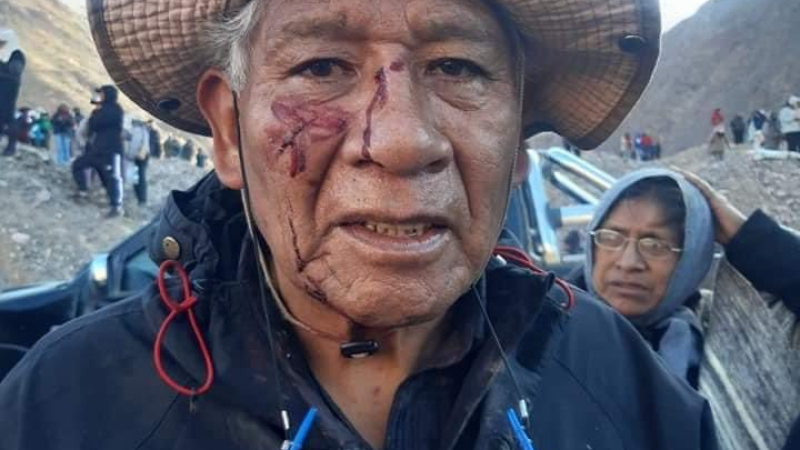 Jujuy: la mitad de los habitantes es pobre y 78.000 personas pasan hambre