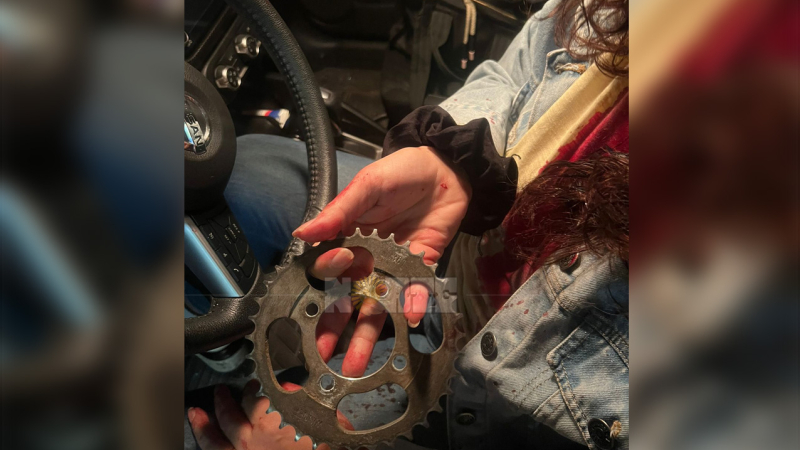 Una noche de terror: peleas, desidia policial y demora en la asistencia médica