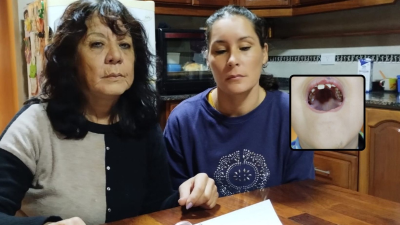 Exigen que se investigue un "supuesto accidente" que sufrió un niño autista en un colegio de Sáenz Peña