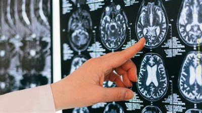 Conocé los hábitos aparentemente sin importancia que dañan tu cerebro