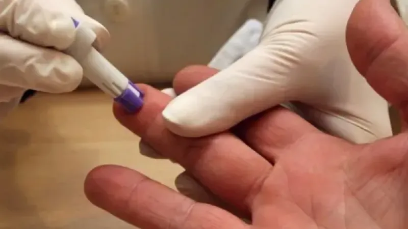 Es posible terminar con el VIH si se garantiza el test, la atención y el tratamiento