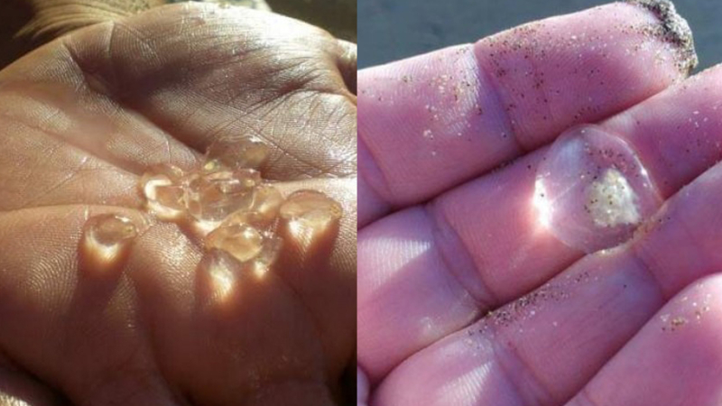 Las picaduras en las playas de la costa atlántica