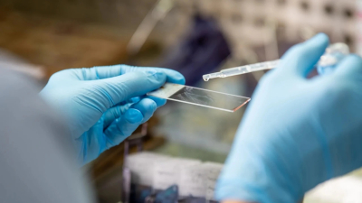 El Chaco busca reactivar los tests para detección del virus de papiloma humano