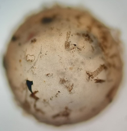 huevo de Titanolebias calvinoi bajo microscopio.jpeg