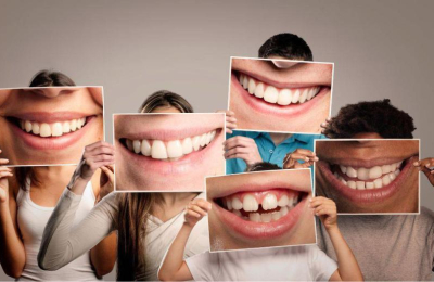 El azúcar no es el único enemigo: qué otros alimentos amenazan a nuestros dientes
