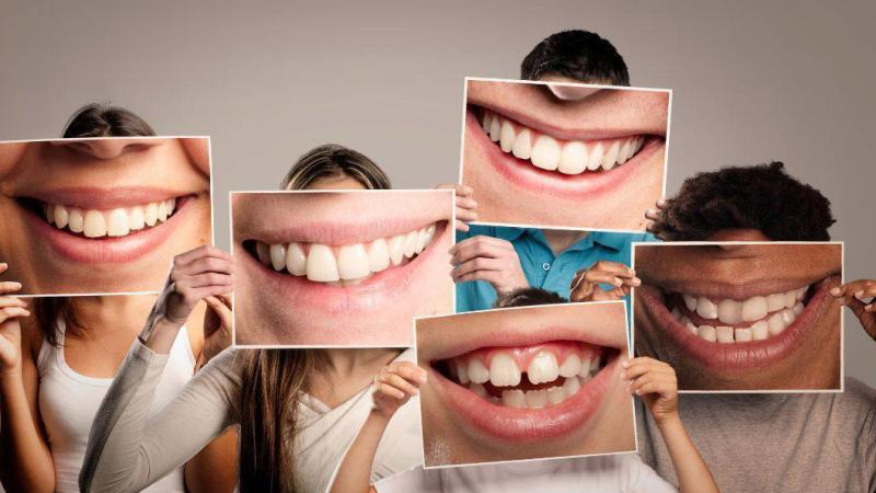 El azúcar no es el único enemigo: qué otros alimentos amenazan a nuestros dientes