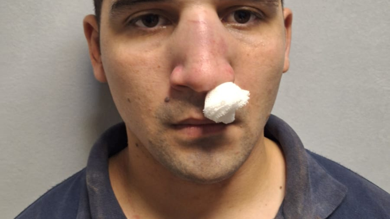 Batalla campal al termino de la Liga Saenzpeñense: un policía resultó herido