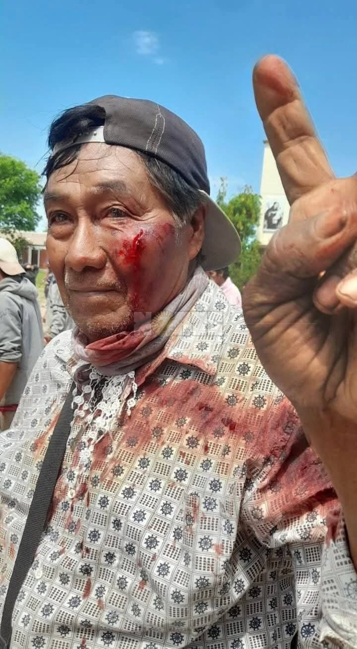 golpeado tres.jpg
