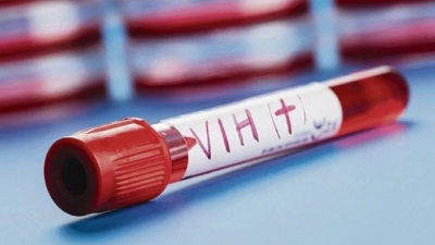 Avance argentino en VIH: presentan esquema de tratamiento con sólo dos drogas