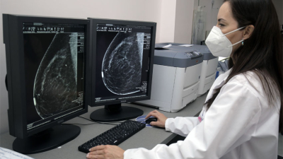 Los controles para detectar cáncer mamario disminuyeron a causa del Covid-19