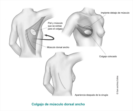 pag8-elsa-1.jpg