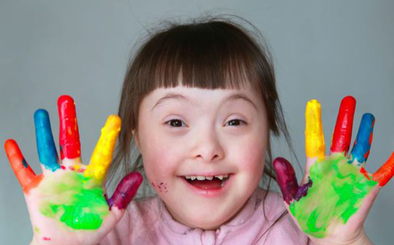 down-syndrome-.jpg