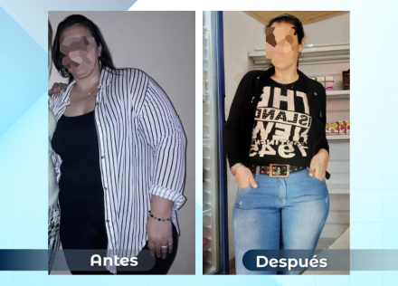 1antesydespues01.jpg