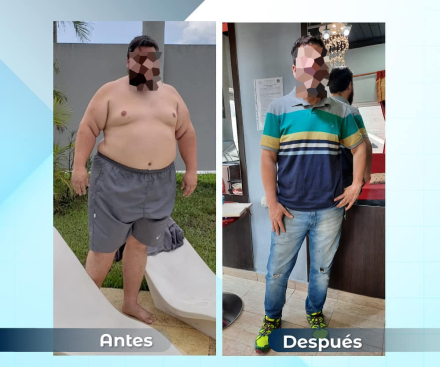 1antesydespues14.jpg