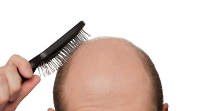 Tomar gaseosa y hacer dieta puede provocar caída del pelo
