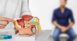 cancer de prostata.jpg